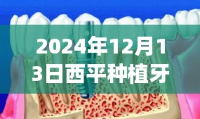 2024年12月13日西平种植牙实时价格指南，初学者与进阶用户全攻略